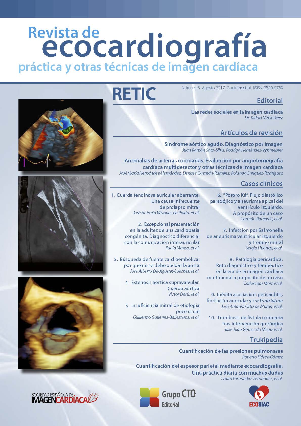 					Ver Núm. 5 (2017): Revista de Ecocardiografía Práctica y Otras Técnicas de Imagen Cardíaca
				