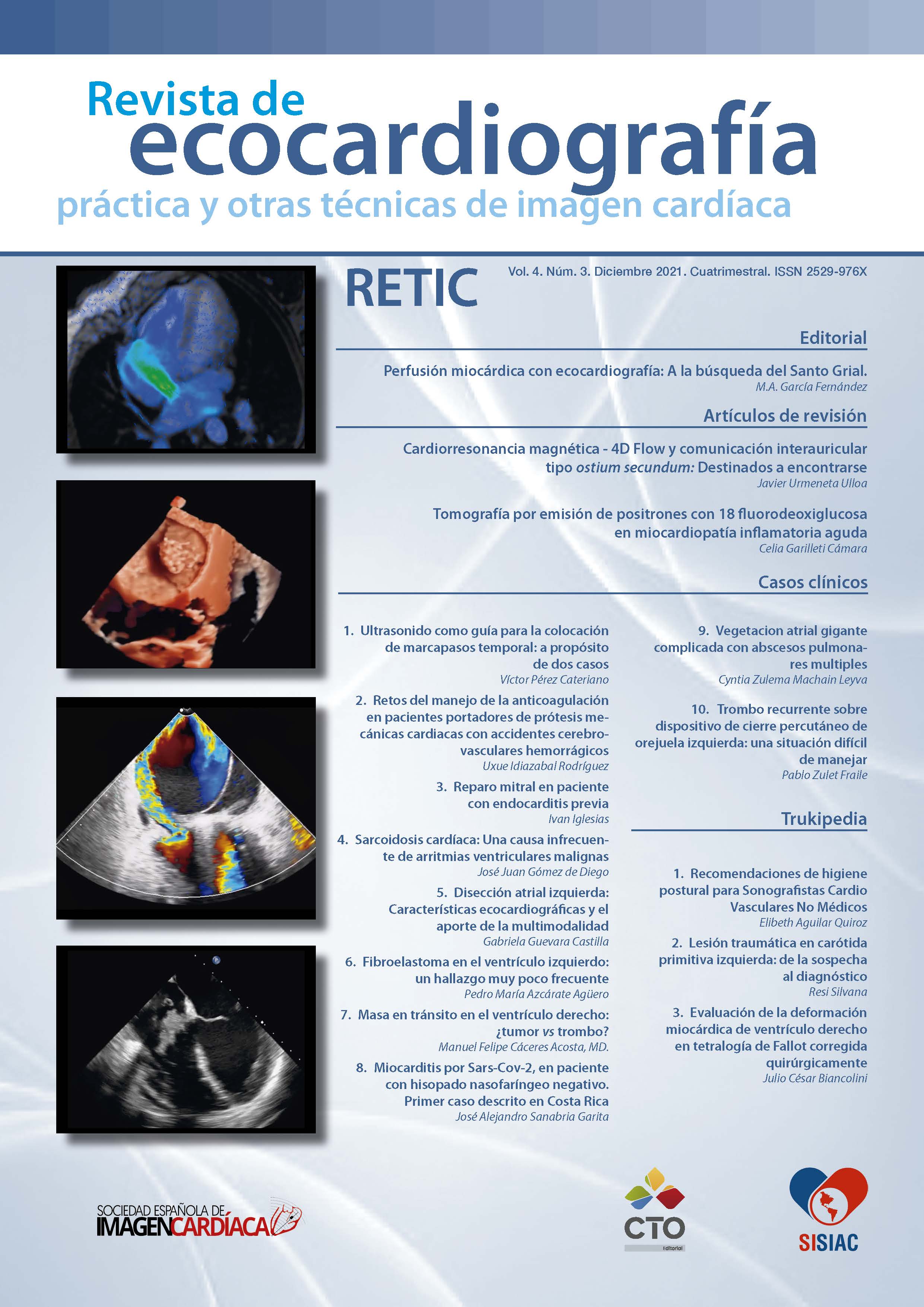 					Ver Vol. 4 Núm. 3 (2021): Revista de Ecocardiografía Práctica y Otras Técnicas de Imagen Cardíaca
				