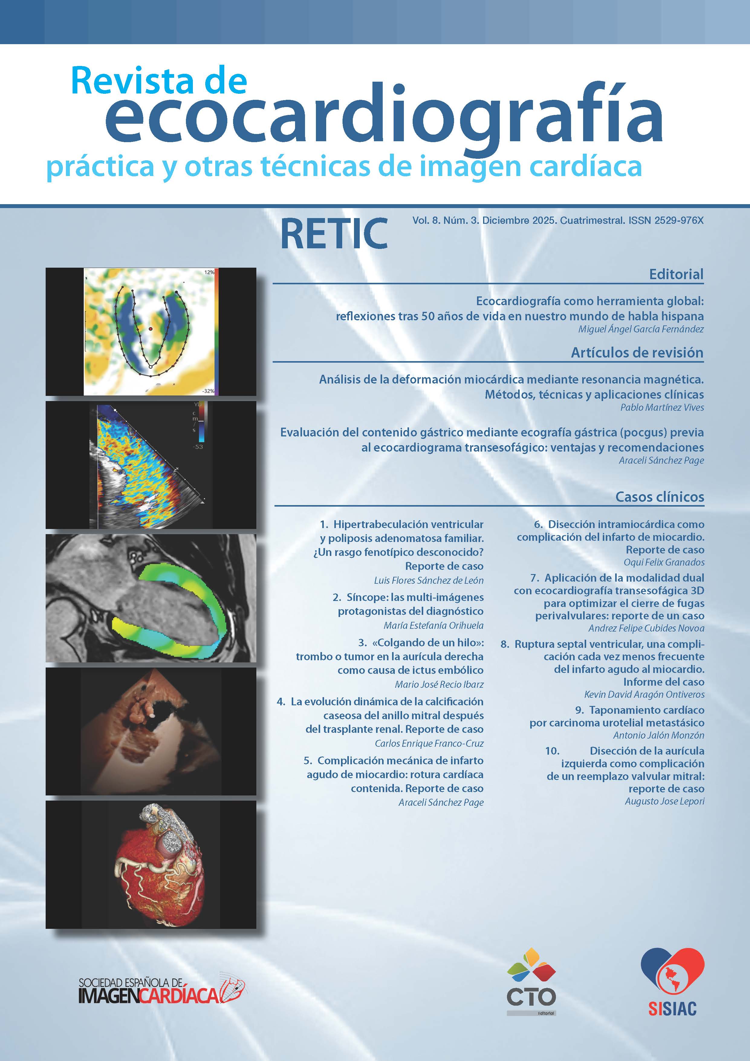 					Ver Vol. 8 Núm. 3 (2025): Revista de Ecocardiografía Práctica y Otras Técnicas de Imagen Cardíaca
				