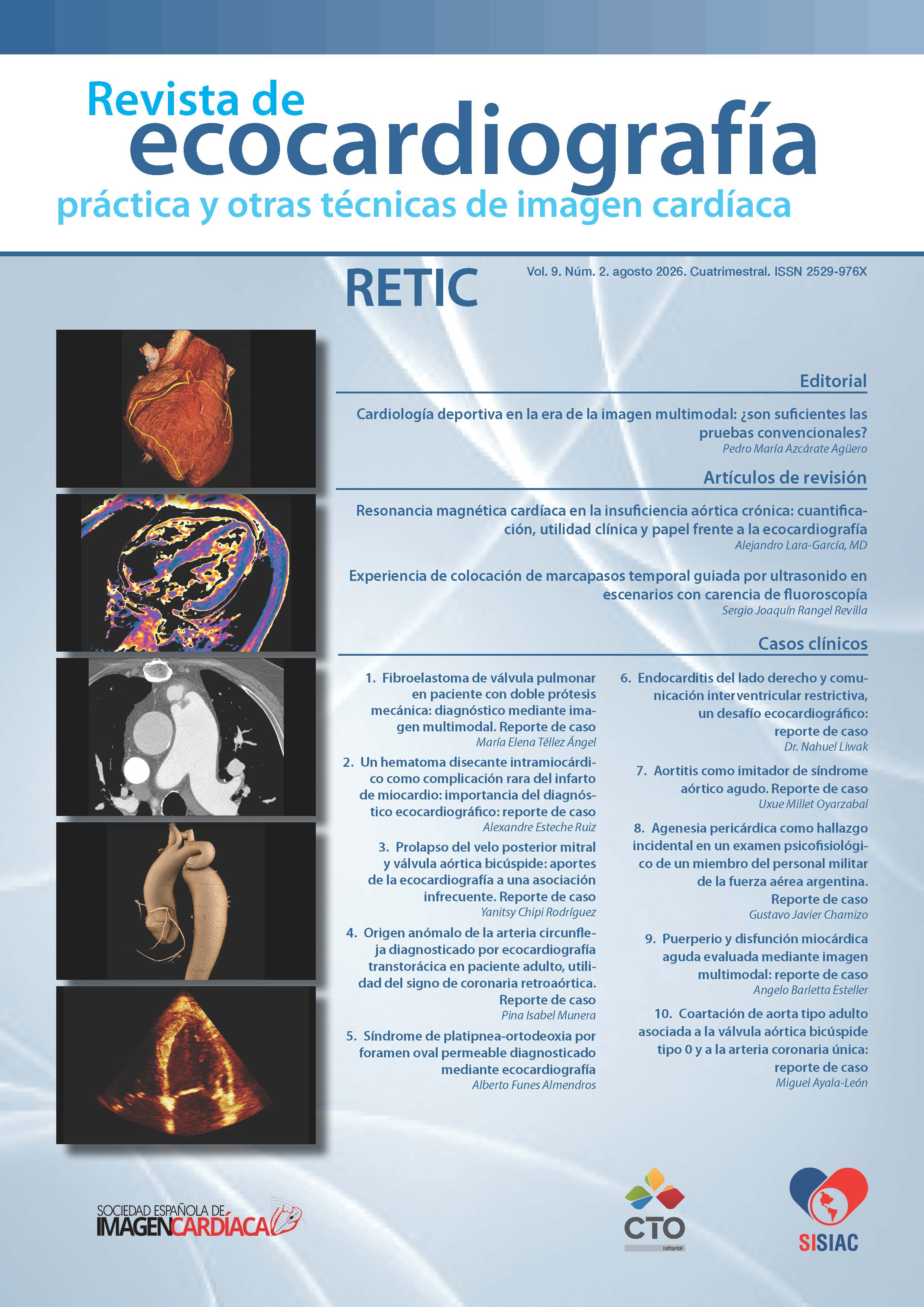 					Ver Vol. 9 Núm. 2 (2026): Revista de Ecocardiografía Práctica y Otras Técnicas de Imagen Cardíaca
				